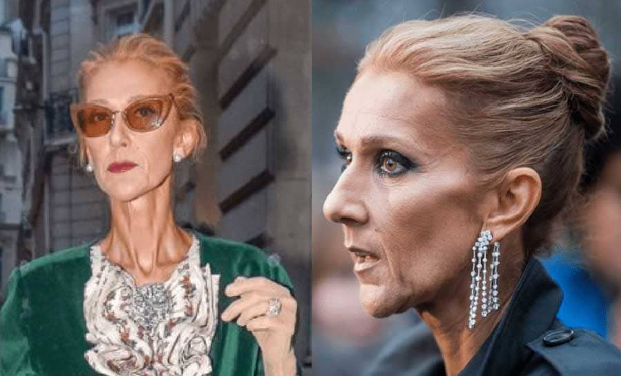 Celine Dion Est Elle Décédée